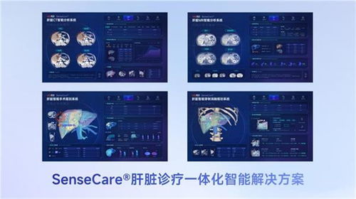 商汤医疗获肝脏CT辅助诊断NMPA三类证，软硬件零售赋能肝脏诊疗一体化新格局
